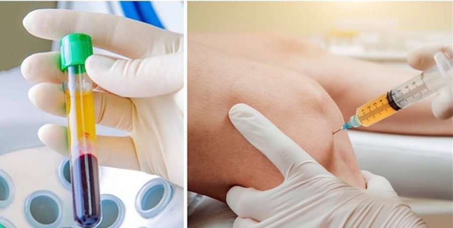 Вілентіс|Вилентис Кропивницкий