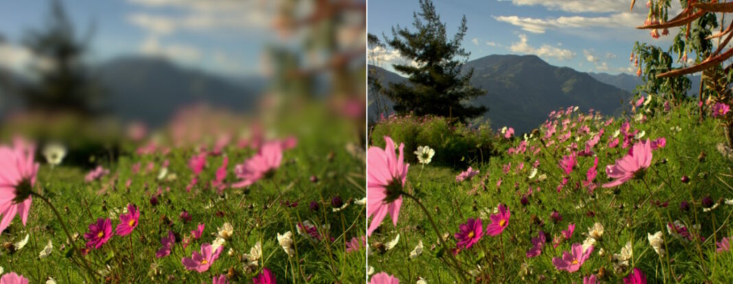 Можно ли остановить развитие близорукости без операции?