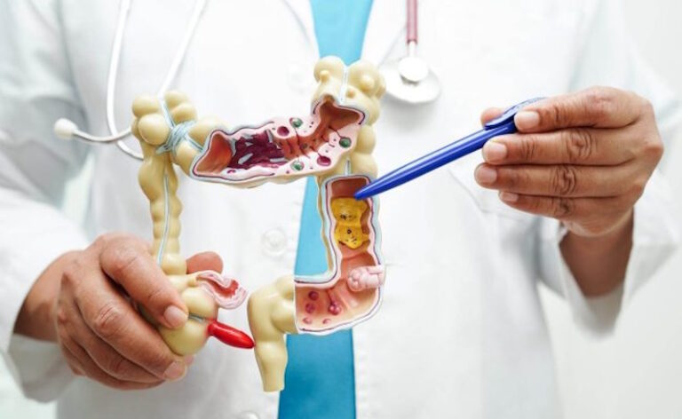 Хірургія у проктології